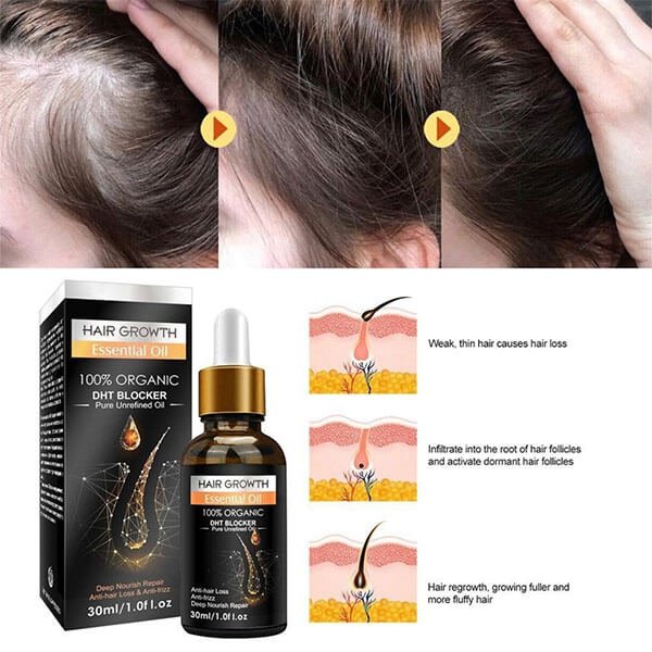 Buy Hair Growth Essential Oil Biotin Cold-Pressed DHT Blocker at Rs. 1800 from Likeshop.pk